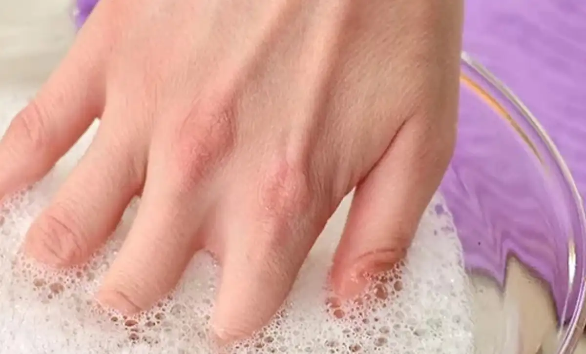 نحوه پاک کردن چسب 123 از روی دست